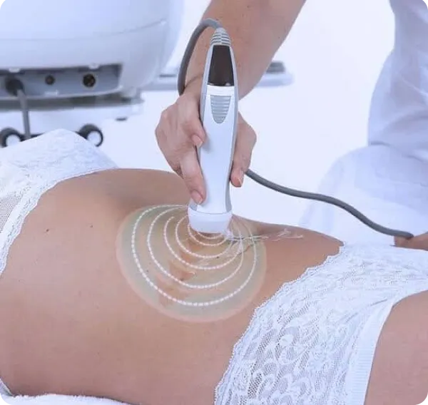 Radiofréquence Corpoderm